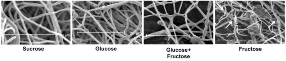 Scanning electron micrographs of fungal mycelium grown on various feedstocks