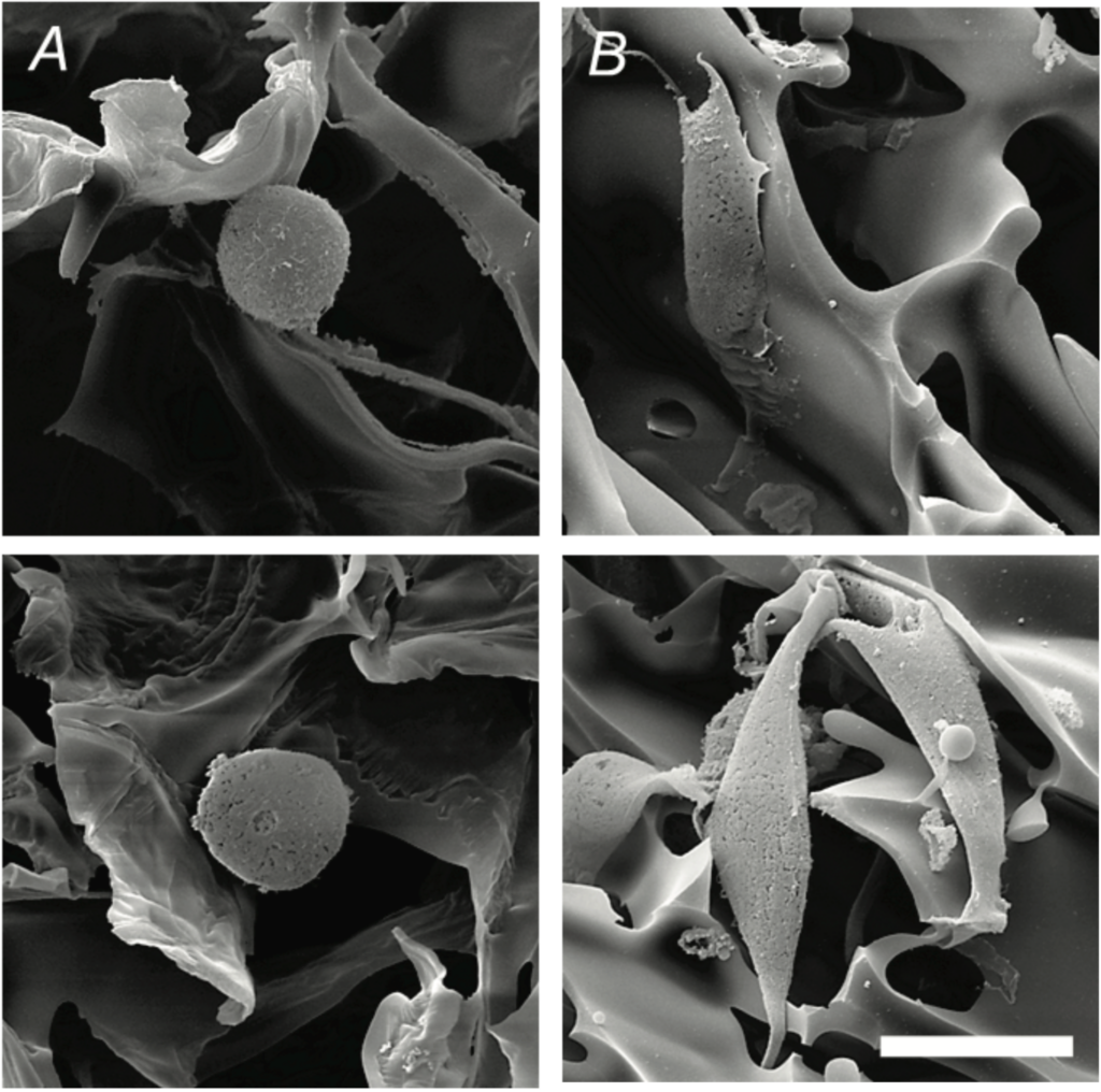 Scanning electron micrographs showing examples of cells growing on a hydrogel scaffold.